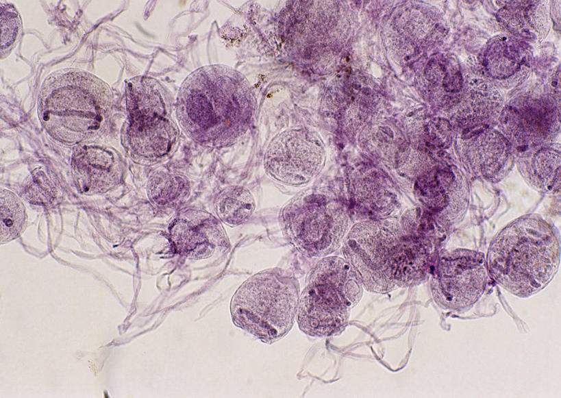 无人,横图,室内,特写,白天,白色背景,正面,微生物,许多,科学,医学,昆虫,细胞,紫色,动物,生物学,害虫,显微图片,蜉蝣,自然科学,博物学,生物科学,彩图