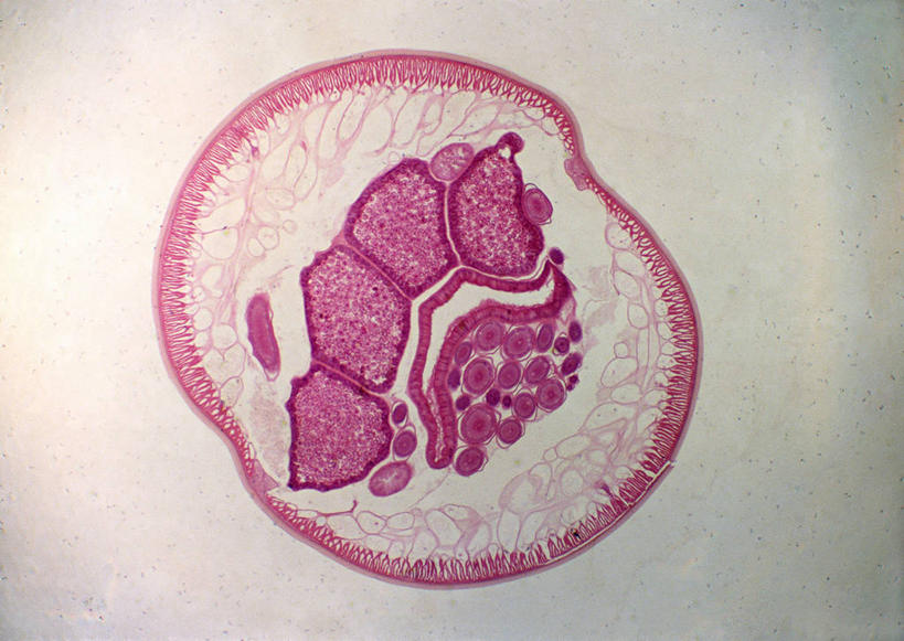 无人,横图,俯视,室内,特写,白天,仪器,微生物,许多,检查,反射,分析,科学,医学,圆形,细胞,显微镜,很多,无脊椎动物,粉色,紫色,白色,观察,清晰,探索,放大,观看,仔细,透镜,生物学,凸透镜,聚焦,关注,光学,清楚,寄生,寄生虫,蠕虫,蛔虫,显微图片,线虫,彩图,高角度拍摄