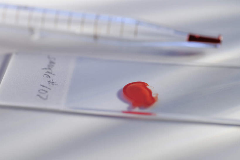 无人,横图,俯视,室内,特写,白天,白色背景,实验,仪器,静物,玻璃,一滴,阴影,朦胧,模糊,研究,透明,反射,分析,化学,测试,滴管,影子,玻璃制品,红色,器皿,血液,摄影,影棚,计量,载玻片,玻璃仪器,试验耗材,实验用品,吸液管,移液管,玻片,盖玻片,彩图,高角度拍摄,影棚拍摄,拍摄