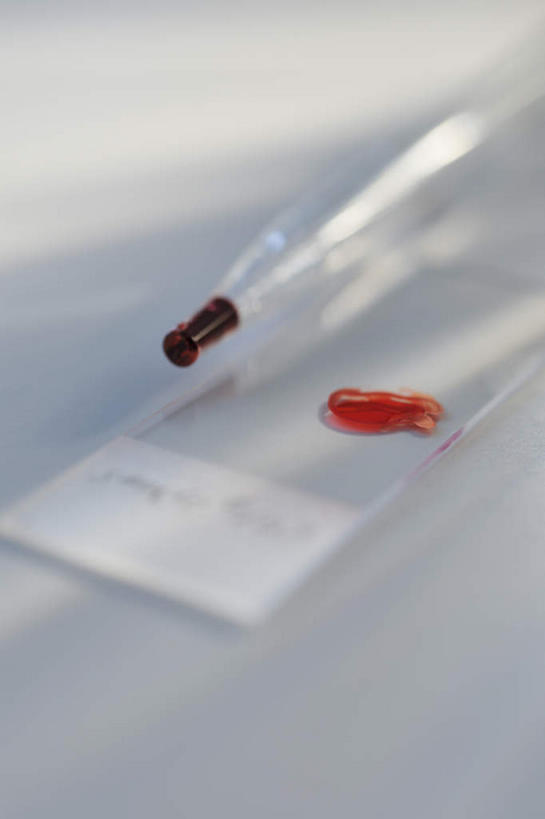 无人,竖图,俯视,室内,特写,白天,白色背景,实验,仪器,静物,玻璃,一滴,阴影,朦胧,模糊,研究,透明,反射,分析,化学,测试,滴管,影子,玻璃制品,红色,器皿,血液,摄影,影棚,计量,载玻片,玻璃仪器,试验耗材,实验用品,吸液管,移液管,玻片,盖玻片,彩图,高角度拍摄,影棚拍摄,拍摄