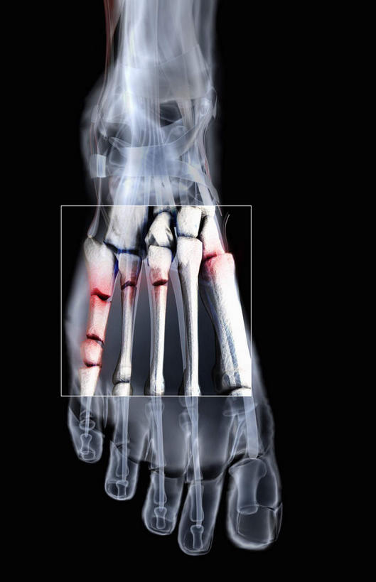 动脉,静脉,骨骼,关节,无人,竖图,插画,x光片,室内,特写,白天,正面,数码,科技,静物,阴影,黑色背景,辐射,科学,网络,医学,骨头,高光,几何,计算机图形,合成,图画,画,模型,人体,电脑合成图,数码合成图,骨架,医疗,生物学,科学技术,x射线,x光,漫画,生理学,写实,具体,具象,腓骨,跗骨,胫骨,趾骨,半身,彩图,电磁波,电磁辐射