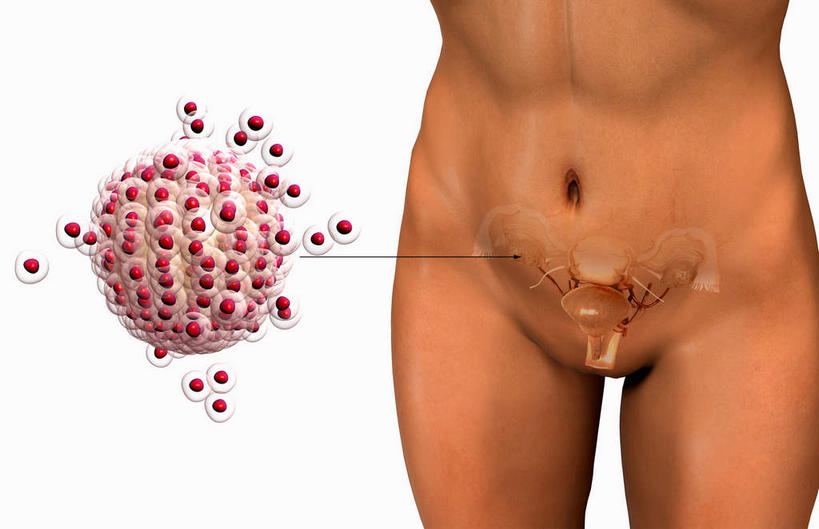 肌肉,子宫,阴道,健壮,无人,竖图,插画,室内,特写,白天,白色背景,正面,数码,科技,静物,阴影,网络,医学,细胞,高光,几何,计算机图形,合成,图画,裸露,画,红色,健康,球体,活力,力量,人体,赤裸,青春,电脑合成图,数码合成图,生物学,强壮,裸,漫画,输卵管,生理学,写实,具体,具象,卵,半身,彩图,生殖系统,受精卵