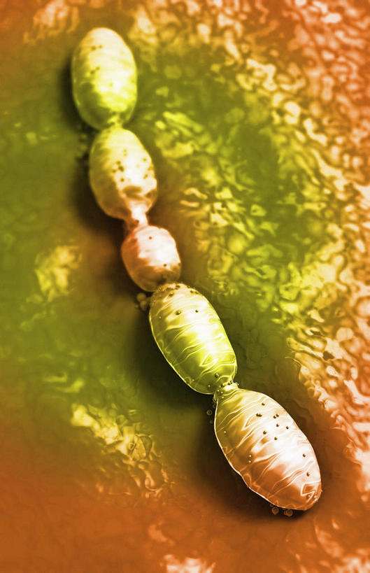 无人,竖图,插画,室内,白天,正面,数码,科技,静物,阴影,网络,医学,高光,几何,计算机图形,合成,图画,画,生物,人体,电脑合成图,数码合成图,医疗,疾病,生物学,漫画,生理学,写实,具体,具象,肺炎,彩图