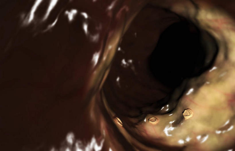 无人,横图,插画,室内,白天,正面,数码,科技,微生物,静物,阴影,网络,医学,细胞,高光,几何,计算机图形,合成,图画,画,生物,人体,电脑合成图,数码合成图,医疗,生物学,漫画,生理学,写实,具体,具象,溃疡,寄生,生命体,口腔溃疡,粘膜,彩图