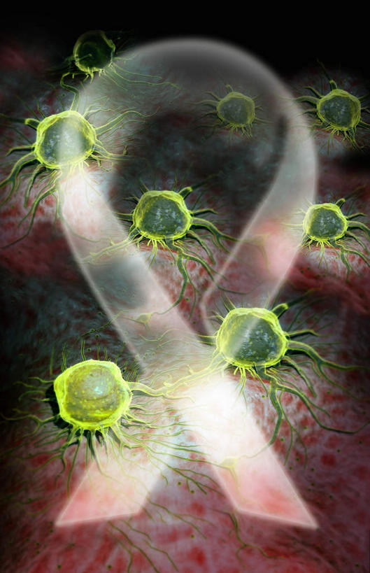 无人,交叉,竖图,插画,室内,白天,白色背景,正面,数码,科技,阴影,网络,医学,高光,几何,计算机图形,合成,图画,画,绿色,球体,生物,电脑合成图,数码合成图,医疗,生物学,漫画,癌症,癌细胞,写实,具体,具象,相交,交集,彩图