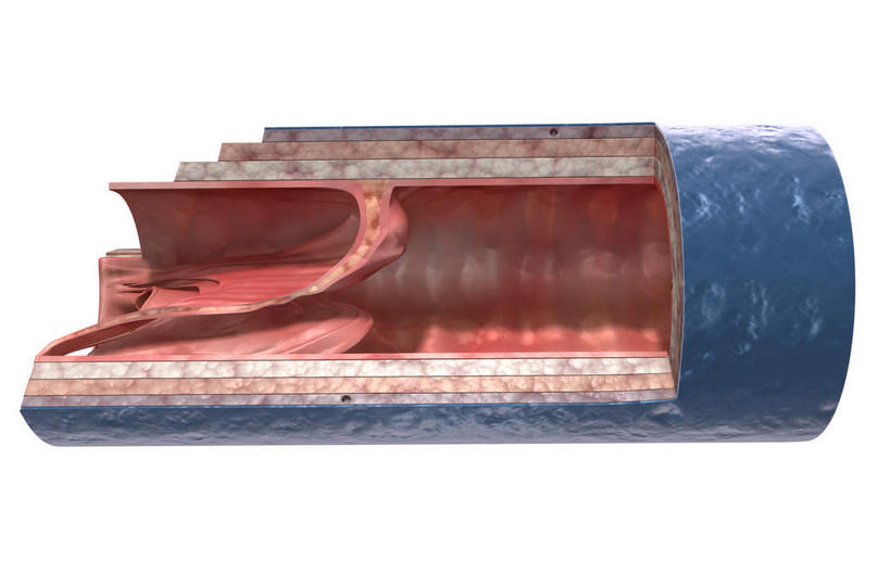 无人,横图,插画,室内,特写,白天,白色背景,正面,数码,科技,阴影,网络,医学,高光,几何,计算机图形,合成,图画,画,血液,电脑合成图,数码合成图,生物学,漫画,生理学,写实,具体,具象,静脉瓣膜,静脉壁,彩图