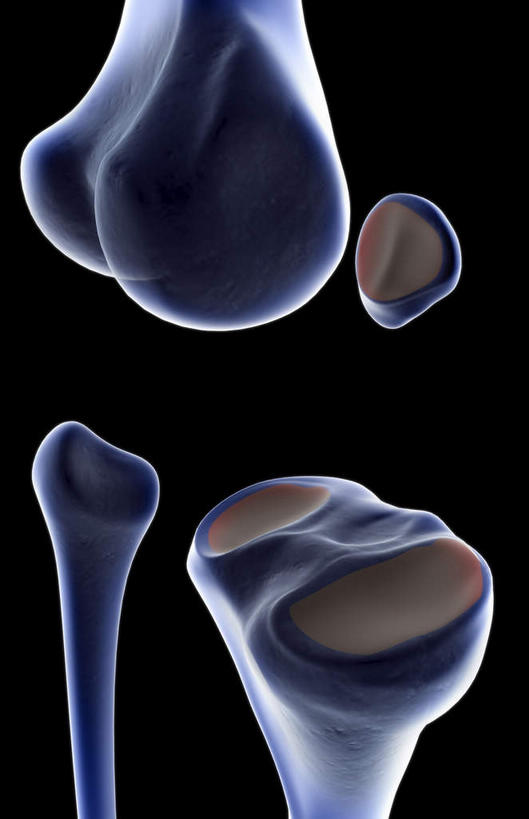 动脉,静脉,骨骼,无人,医院,竖图,插画,x光片,室内,特写,白天,正面,数码,科技,静物,阴影,局部,辐射,科学,网络,医学,骨头,光芒,高光,几何,计算机图形,合成,图画,画,模型,人体,部分,电脑合成图,数码合成图,骨架,医疗,生物学,科学技术,x射线,x光,漫画,医疗机构,生理学,写实,具体,具象,髌骨,股骨髁,胫骨内侧髁,内上髁,外侧髁,外上髁,半身,彩图,病院,诊所,电磁波,电磁辐射