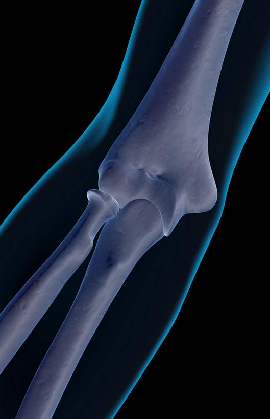 动脉,静脉,骨骼,无人,竖图,插画,x光片,室内,特写,白天,正面,数码,科技,静物,阴影,黑色背景,局部,辐射,科学,网络,医学,骨头,光芒,高光,几何,计算机图形,合成,图画,画,模型,人体,部分,电脑合成图,数码合成图,骨架,医疗,生物学,科学技术,x射线,x光,漫画,生理学,写实,具体,具象,手肘,内上髁,外侧髁,外上髁,半身,彩图,电磁波,电磁辐射