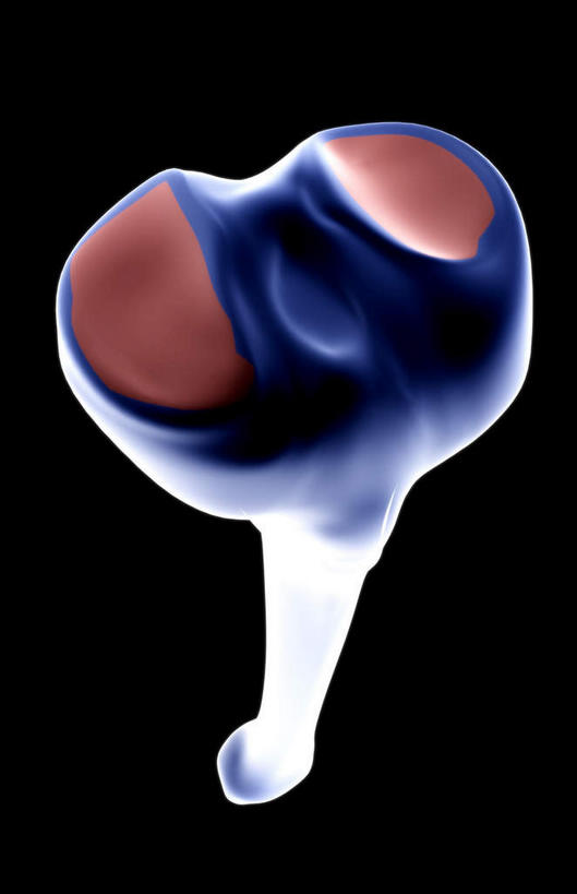 动脉,静脉,骨骼,无人,医院,竖图,插画,x光片,室内,特写,白天,正面,数码,科技,静物,阴影,局部,辐射,科学,网络,医学,骨头,高光,几何,计算机图形,合成,图画,画,模型,人体,部分,电脑合成图,数码合成图,骨架,医疗,生物学,科学技术,x射线,x光,漫画,医疗机构,生理学,写实,具体,具象,胫骨,胫骨内侧髁,半身,彩图,病院,诊所,电磁波,电磁辐射