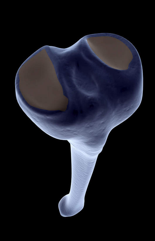 动脉,静脉,骨骼,无人,竖图,插画,x光片,室内,特写,白天,正面,数码,科技,静物,阴影,黑色背景,局部,辐射,科学,网络,医学,骨头,光芒,高光,几何,计算机图形,合成,图画,画,模型,人体,部分,电脑合成图,数码合成图,骨架,医疗,生物学,科学技术,x射线,x光,漫画,生理学,写实,具体,具象,胫骨,胫骨内侧髁,半身,彩图,电磁波,电磁辐射