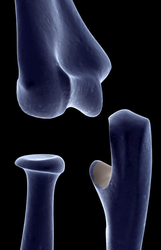 动脉,静脉,骨骼,无人,竖图,插画,x光片,室内,特写,白天,正面,数码,科技,静物,阴影,黑色背景,辐射,科学,网络,医学,骨头,高光,几何,计算机图形,合成,图画,画,模型,人体,电脑合成图,数码合成图,骨架,医疗,生物学,科学技术,x射线,x光,漫画,生理学,写实,具体,具象,指骨,骨关节,彩图,电磁波,电磁辐射