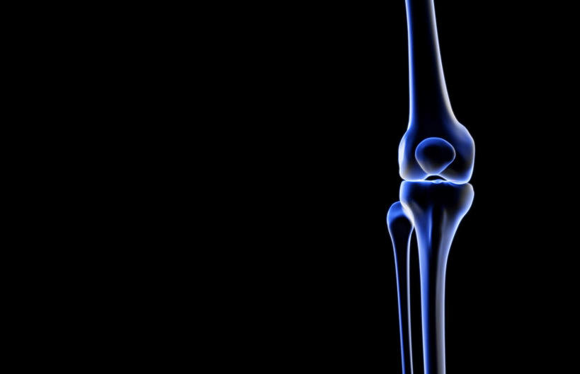 膝关节,动脉,静脉,骨骼,无人,横图,插画,x光片,室内,特写,白天,正面,数码,科技,静物,阴影,黑色背景,辐射,科学,网络,医学,骨头,高光,几何,计算机图形,合成,图画,画,模型,人体,电脑合成图,数码合成图,骨架,医疗,生物学,科学技术,x射线,x光,漫画,生理学,写实,具体,具象,髌骨,腓骨,股骨,骨关节,彩图,电磁波,电磁辐射