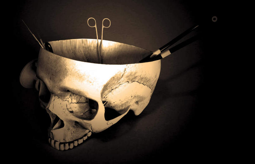 颅骨,骨骼,无人,横图,插画,室内,白天,正面,数码,科技,静物,金属制品,阴影,黑色背景,网络,医学,金属,工具,钳子,骨头,高光,几何,计算机图形,合成,图画,画,一个,人体,单个,电脑合成图,数码合成图,骨架,生物学,医疗器械,医疗工具,漫画,手术钳,生理学,写实,具体,具象,开颅手术,头盖骨,彩图