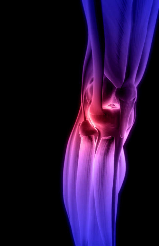 腿部,膝盖,肌肉,腿,健壮,无人,竖图,插画,室内,白天,正面,数码,科技,静物,阴影,黑色背景,局部,网络,医学,高光,几何,计算机图形,合成,图画,画,健康,活力,力量,人体,青春,电脑合成图,数码合成图,生物学,强壮,漫画,生理学,写实,具体,具象,髌韧带,胫骨前肌,彩图