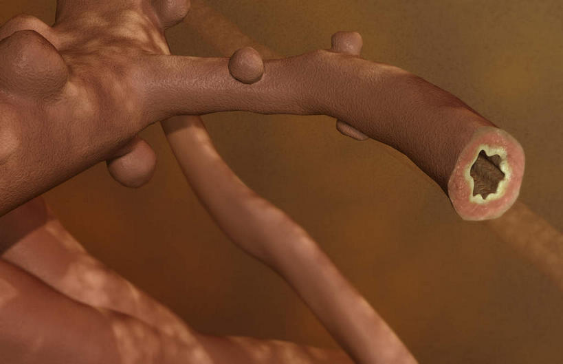 无人,横图,插画,室内,特写,白天,正面,数码,科技,静物,阴影,黑色背景,网络,医学,高光,几何,计算机图形,合成,图画,画,人体,电脑合成图,数码合成图,生物学,漫画,支气管,生理学,写实,具体,具象,细支气管,呼吸系统,平滑肌,彩图