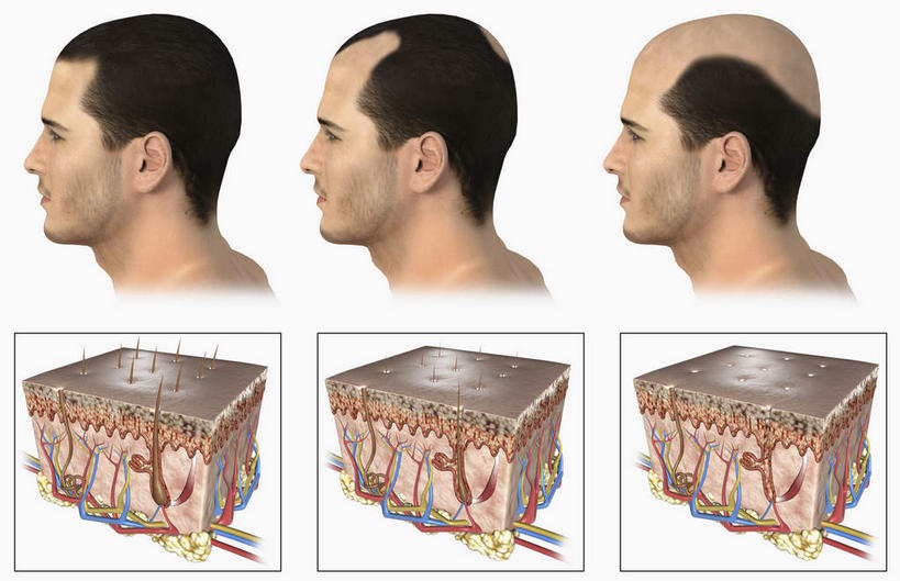 脸,头,脸颊,动脉,静脉,骨骼,无人,站,横图,插画,x光片,室内,特写,白天,白色背景,正面,数码,科技,静物,一排,阴影,整齐,辐射,科学,网络,医学,支架,骨头,高光,几何,计算机图形,合成,图画,画,排列,模型,站着,人体,皮肤,电脑合成图,数码合成图,骨架,医疗,生物学,科学技术,x射线,队列,x光,漫画,生理学,写实,具体,具象,毛囊,头皮,头部,脸部,脸蛋,面部,站立,彩图,电磁波,电磁辐射