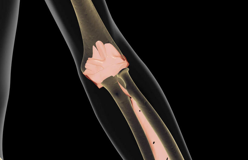 动脉,静脉,骨骼,关节,无人,横图,插画,x光片,室内,特写,白天,正面,数码,科技,静物,阴影,黑色背景,辐射,科学,网络,医学,骨头,高光,几何,计算机图形,合成,图画,画,模型,人体,电脑合成图,数码合成图,骨架,医疗,生物学,科学技术,x射线,x光,韧带,漫画,生理学,写实,具体,具象,环状韧带,桡侧副韧带,肘部,彩图,电磁波,电磁辐射