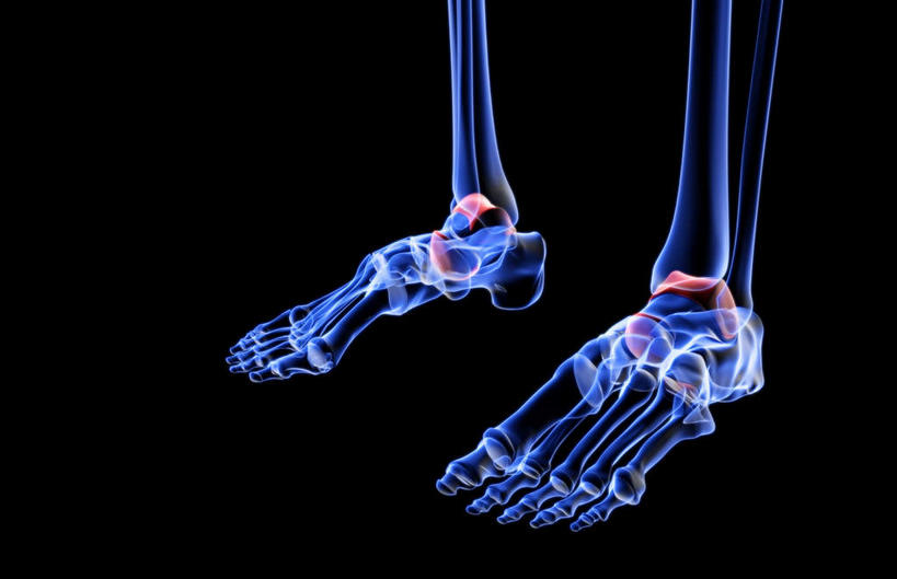 腿部,脚,脚趾,脚趾甲,腿,无人,横图,插画,x光片,室内,白天,正面,数码,科技,阴影,黑色背景,辐射,科学,网络,医学,高光,几何,计算机图形,合成,图画,画,电脑合成图,数码合成图,医疗,科学技术,x射线,x光,漫画,写实,具体,具象,指骨,手舟骨,跖骨,足骨,脚指甲,彩图,电磁波,电磁辐射