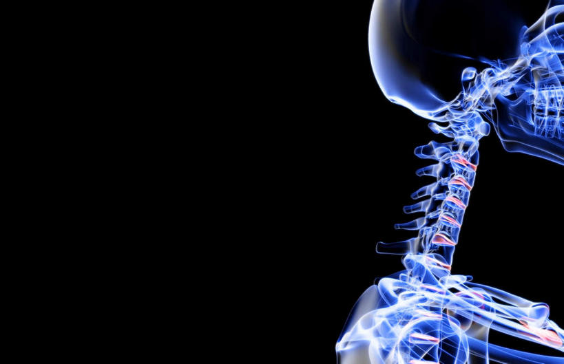 脸,头,脸颊,脖子,颅骨,动脉,静脉,骨骼,无人,横图,插画,x光片,室内,特写,白天,正面,数码,科技,静物,阴影,黑色背景,发光,辐射,科学,网络,医学,骨头,高光,几何,计算机图形,合成,图画,画,蓝色,模型,人体,电脑合成图,数码合成图,骨架,医疗,生物学,科学技术,x射线,x光,漫画,生理学,写实,具体,具象,耳道,颈椎骨,头盖骨,头部,脖,颈,颈部,脸部,脸蛋,面部,彩图,电磁波,电磁辐射