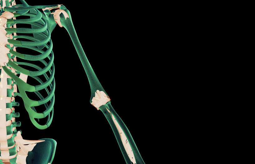 无人,站,横图,插画,x光片,室内,白天,正面,数码,科技,阴影,黑色背景,发光,辐射,科学,网络,医学,高光,几何,计算机图形,合成,图画,画,绿色,站着,皮肤,电脑合成图,数码合成图,医疗,科学技术,x射线,x光,韧带,漫画,写实,具体,具象,环状韧带,手臂,站立,彩图,电磁波,电磁辐射