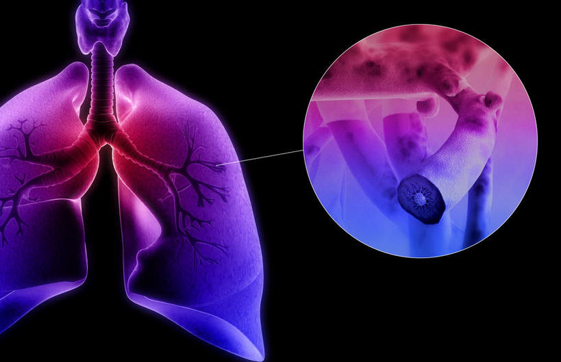 内脏,动脉,静脉,无人,横图,插画,室内,白天,白色背景,正面,数码,科技,静物,阴影,发光,网络,医学,高光,几何,计算机图形,合成,图画,画,紫色,模型,人体,电脑合成图,数码合成图,生物学,人体器官,解剖,器官,哮喘,漫画,花粉,过敏,生理学,写实,具体,具象,过敏反应,花粉症,彩图,剖解