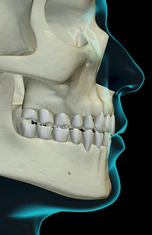 骨骼,无人,竖图,x光片,室内,白天,正面,数码,科技,阴影,黑色背景,辐射,科学,网络,医学,骨头,高光,几何,计算机图形,合成,皮肤,电脑合成图,数码合成图,骨架,医疗,科学技术,x射线,x光,写实,具体,具象,颚骨,半身,彩图,电磁波,电磁辐射