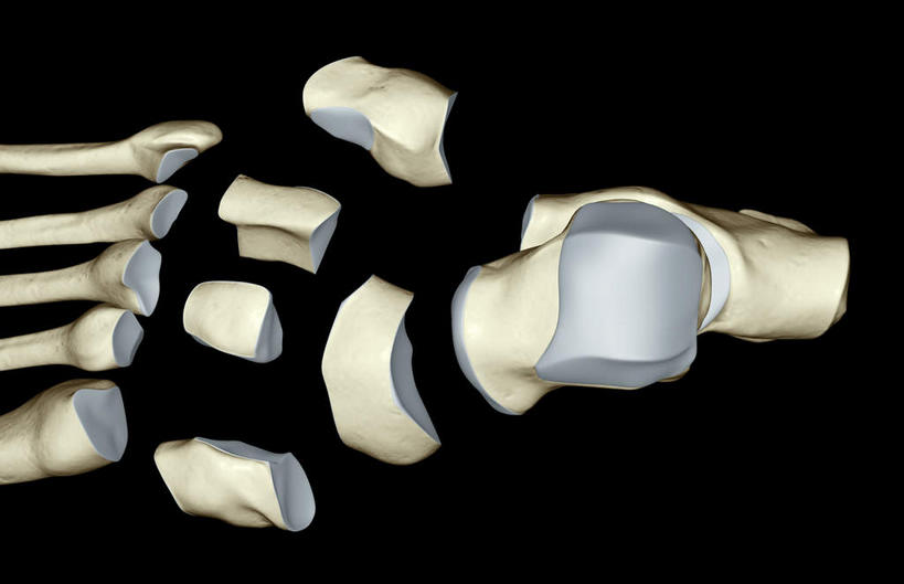 腿部,脚,脚趾,脚趾甲,骨骼,腿,无人,横图,x光片,室内,白天,正面,数码,科技,阴影,黑色背景,辐射,科学,网络,医学,骨头,高光,几何,计算机图形,合成,电脑合成图,数码合成图,骨架,医疗,科学技术,x射线,x光,写实,具体,具象,舟骨,足骨,脚指甲,彩图,电磁波,电磁辐射