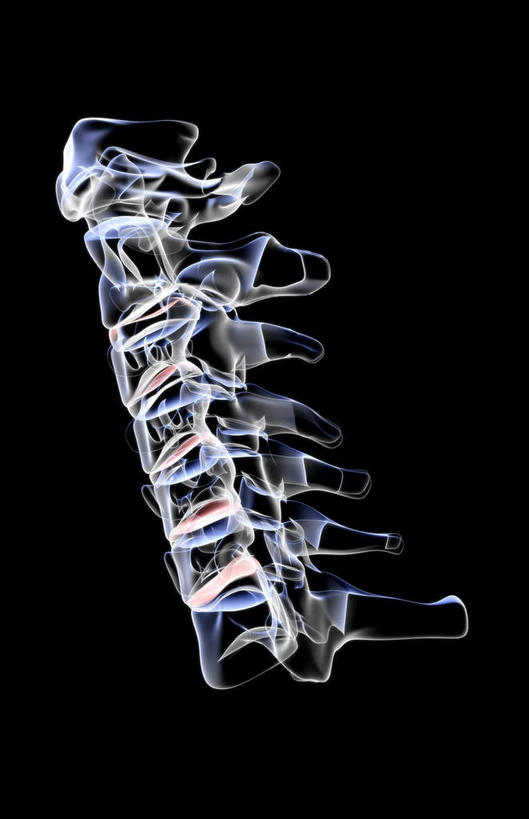 骨骼,无人,竖图,x光片,室内,白天,正面,数码,科技,阴影,黑色背景,辐射,科学,网络,医学,骨头,高光,几何,计算机图形,合成,电脑合成图,数码合成图,骨架,医疗,科学技术,x射线,x光,写实,具体,具象,颈椎,腰椎,彩图,电磁波,电磁辐射