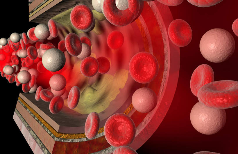 内脏,动脉,静脉,血管,无人,横图,室内,特写,白天,正面,数码,科技,静物,阴影,黑色背景,网络,医学,高光,几何,计算机图形,合成,红色,模型,人体,电脑合成图,数码合成图,疾病,生物学,人体器官,器官,生理学,写实,具体,具象,动脉硬化,动脉粥样硬化,血管病,彩图