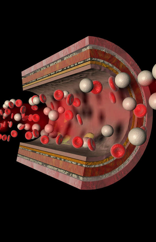 内脏,动脉,静脉,血管,无人,竖图,室内,特写,白天,正面,数码,科技,静物,阴影,黑色背景,网络,医学,高光,几何,计算机图形,合成,红色,模型,人体,电脑合成图,数码合成图,生物学,人体器官,器官,生理学,写实,具体,具象,动脉壁,彩图,血管壁