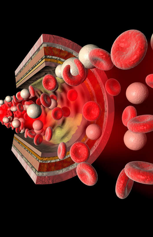 内脏,动脉,静脉,无人,竖图,室内,特写,白天,正面,数码,科技,静物,阴影,黑色背景,网络,医学,高光,几何,计算机图形,合成,红色,模型,人体,电脑合成图,数码合成图,生物学,人体器官,器官,生理学,写实,具体,具象,动脉硬化,动脉粥样硬化,血管病,彩图