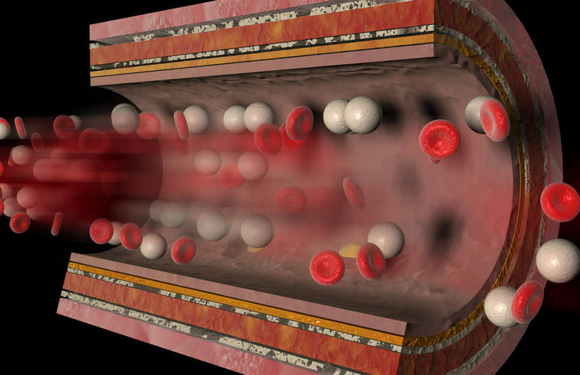 内脏,动脉,静脉,血管,无人,横图,室内,特写,白天,正面,数码,科技,静物,阴影,黑色背景,网络,医学,高光,几何,计算机图形,合成,红色,模型,人体,电脑合成图,数码合成图,生物学,人体器官,器官,生理学,写实,具体,具象,动脉壁,彩图,血管壁