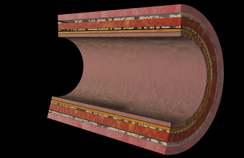 内脏,动脉,静脉,血管,无人,横图,室内,特写,白天,正面,数码,科技,静物,阴影,黑色背景,网络,医学,高光,几何,计算机图形,合成,红色,模型,人体,电脑合成图,数码合成图,生物学,人体器官,器官,生理学,写实,具体,具象,动脉壁,彩图,血管膜