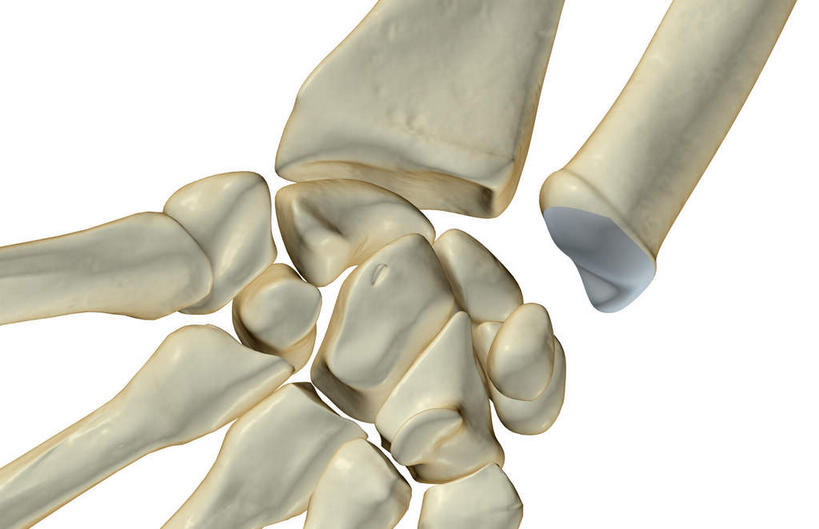 动脉,静脉,骨骼,无人,横图,插画,室内,特写,白天,白色背景,正面,数码,科技,静物,阴影,网络,医学,支架,骨头,高光,几何,计算机图形,合成,图画,画,白色,模型,人体,电脑合成图,数码合成图,骨架,生物学,漫画,生理学,写实,具体,具象,腕骨,半身,彩图