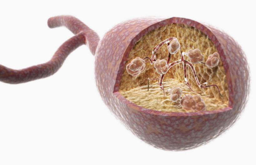 内脏,动脉,静脉,无人,横图,插画,室内,特写,白天,白色背景,正面,数码,科技,静物,阴影,网络,医学,高光,几何,计算机图形,合成,图画,画,红色,模型,人体,电脑合成图,数码合成图,疾病,生物学,人体器官,器官,漫画,生理学,写实,具体,具象,乳腺,乳腺小叶,彩图