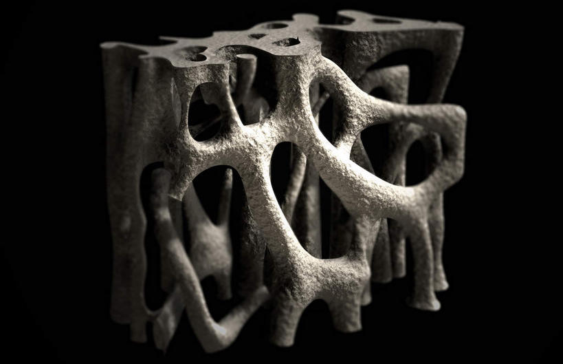 动脉,静脉,骨骼,无人,横图,插画,x光片,室内,特写,白天,正面,数码,科技,静物,一堆,阴影,堆叠,堆积,黑色背景,辐射,科学,网络,医学,支架,骨头,高光,几何,计算机图形,合成,图画,画,白色,模型,人体,堆,电脑合成图,数码合成图,骨架,生物学,科学技术,x射线,x光,漫画,生理学,写实,具体,具象,骨质疏松,彩图,电磁波,电磁辐射