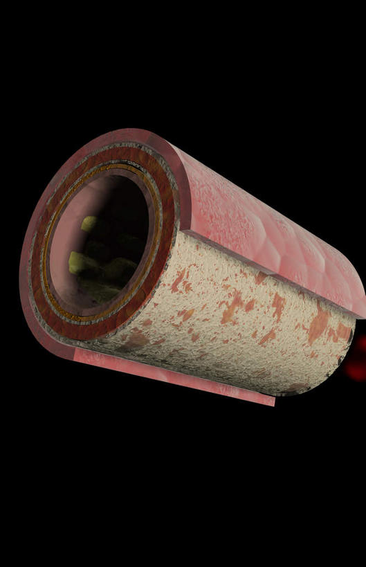 血管,无人,竖图,插画,室内,特写,白天,正面,数码,科技,静物,阴影,黑色背景,网络,医学,细胞,高光,几何,计算机图形,合成,图画,画,人体,电脑合成图,数码合成图,生物学,漫画,生理学,写实,具体,具象,内皮,动脉壁,内膜,外耳炎,中膜,彩图,血管壁