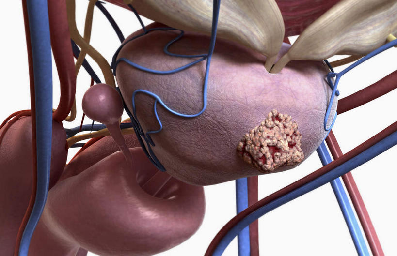 内脏,动脉,静脉,血管,无人,横图,插画,室内,特写,白天,白色背景,正面,数码,科技,静物,阴影,网络,医学,高光,几何,计算机图形,合成,图画,画,红色,模型,人体,电脑合成图,数码合成图,生物学,人体器官,器官,漫画,癌症,生理学,写实,具体,具象,乳腺,前列腺癌,彩图