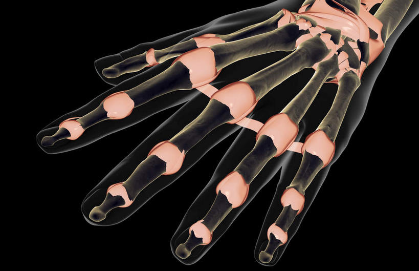 手,动脉,静脉,骨骼,无人,横图,插画,x光片,室内,特写,白天,正面,数码,科技,静物,伸展,张开,阴影,黑色背景,局部,辐射,科学,网络,医学,骨头,光芒,高光,几何,计算机图形,合成,图画,画,模型,手部,伸直,人体,部分,电脑合成图,数码合成图,骨架,医疗,生物学,科学技术,x射线,x光,韧带,漫画,生理学,写实,具体,具象,腕骨,掌骨,指骨,半身,彩图,五指张开,前纵韧带,电磁波,电磁辐射