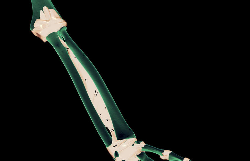 动脉,静脉,骨骼,无人,横图,插画,x光片,室内,特写,白天,正面,数码,科技,静物,阴影,黑色背景,局部,辐射,科学,网络,医学,骨头,光芒,高光,几何,计算机图形,合成,图画,画,模型,人体,部分,电脑合成图,数码合成图,骨架,医疗,生物学,科学技术,x射线,x光,韧带,漫画,生理学,写实,具体,具象,尺骨,桡骨,腕骨,环状韧带,桡侧副韧带,半身,彩图,电磁波,电磁辐射