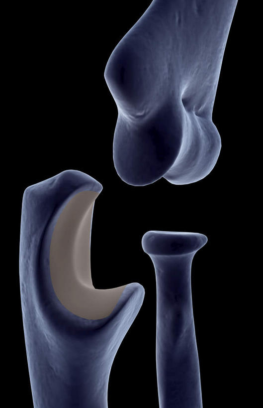 动脉,静脉,骨骼,无人,医院,竖图,插画,室内,特写,白天,正面,数码,科技,静物,阴影,局部,辐射,科学,网络,医学,骨头,高光,几何,计算机图形,合成,图画,画,模型,人体,部分,电脑合成图,数码合成图,骨架,生物学,科学技术,x射线,x光,漫画,医疗机构,生理学,写实,具体,具象,手肘,肱骨,内上髁,半身,彩图,病院,诊所,电磁波,电磁辐射