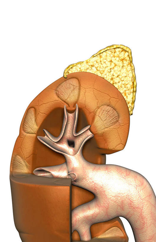 内脏,肾脏,动脉,静脉,无人,竖图,插画,室内,特写,白天,白色背景,正面,数码,科技,静物,阴影,网络,医学,高光,几何,计算机图形,合成,图画,画,红色,模型,人体,电脑合成图,数码合成图,生物学,人体器官,器官,漫画,花萼,生理学,写实,具体,具象,肾窦,肾皮质髓质,肾髓质,彩图