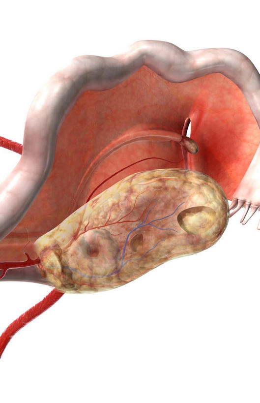 内脏,动脉,静脉,卵巢,子宫,无人,竖图,插画,室内,特写,白天,白色背景,正面,数码,科技,静物,阴影,网络,医学,高光,几何,计算机图形,合成,图画,画,红色,模型,人体,电脑合成图,数码合成图,生物学,人体器官,器官,漫画,输卵管,生理学,写实,具体,具象,彩图