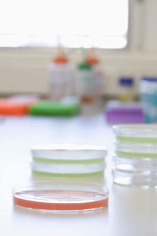 无人,竖图,室内,白天,正面,实验,仪器,窗户,桌子,一堆,许多,堆叠,堆积,朦胧,模糊,研究,分析,化学,测试,培养皿,办公桌,实验室,研究室,很多,玻璃窗,器皿,生物,堆,试验室,试验耗材,实验用品,化学器材,彩图