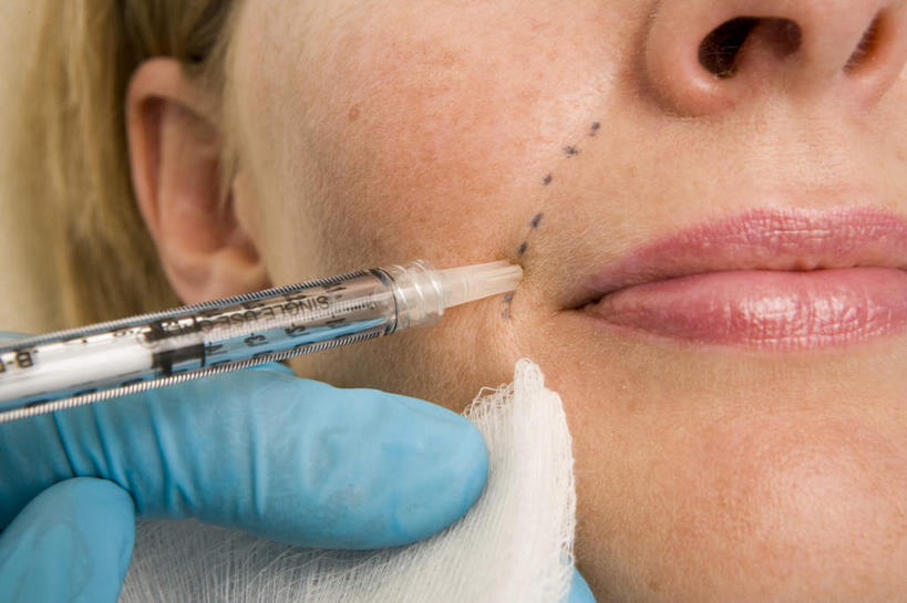 西方人,脸,头,脸颊,手,两个人,医生,病人,站,躺,横图,俯视,室内,特写,白天,欧洲,欧洲人,握,拿,拿着,手套,站着,医护人员,医疗人员,手部,橡胶,针管,针筒,握着,注射,医疗,医疗设备,注射器,病患,橡胶手套,橡胶制品,医用手套,肉毒杆菌,麻醉剂,肉毒杆菌毒素,卧着,男人,男性,女人,女性,中年男性,中年女性,白种人,头部,脸部,脸蛋,面部,大夫,患者,就医者,躺着,卧,站立,半身,彩图,高角度拍摄,肉毒毒素,神经毒素,生物毒素