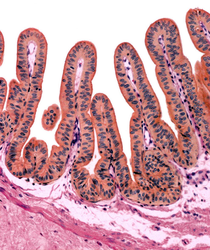 无人,竖图,俯视,室内,特写,白天,仪器,微生物,一排,许多,连接,组合,检查,整齐,反射,分析,科学,医学,细胞,显微镜,很多,排列,红色,紫色,观察,清晰,探索,人体,摄影,放大,观看,仔细,链接,透镜,组织,生物学,凸透镜,紧固,聚焦,队列,关注,拼接,拼凑,光学,拼合,凑集,聚合,撮合,链结,牢固,清楚,摆列,上皮细胞,竖直,彩图,高角度拍摄,拍摄,柱体,布列,分列,上皮组织
