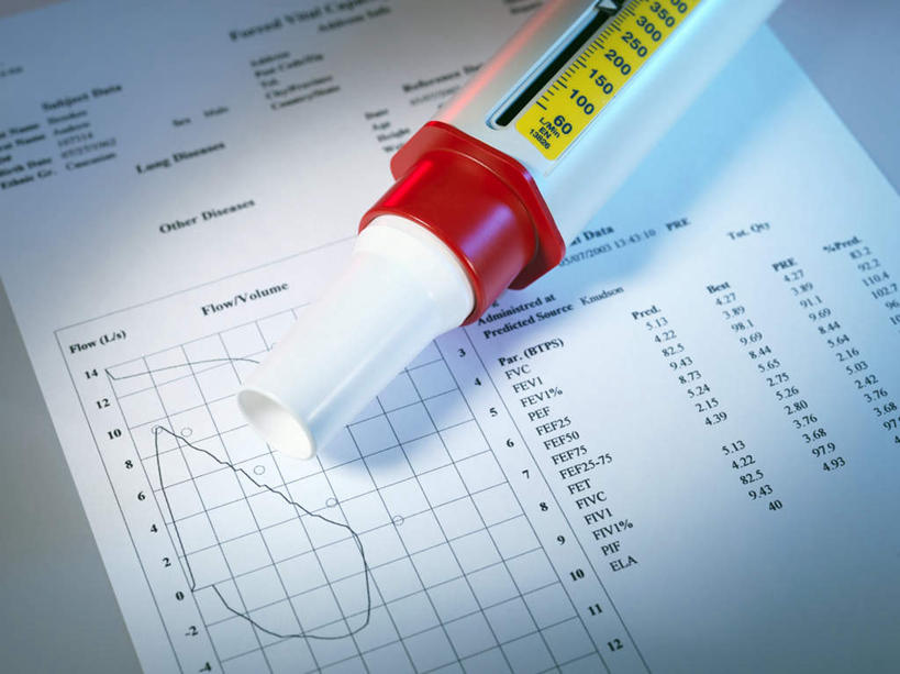 无人,横图,俯视,室内,特写,白天,白色背景,仪器,静物,医学,测试,英文,标志,材料,档案,数字,文件,文字,字符,字母,表格,标识,资料,保健,摄影,阿拉伯数字,影棚,英文字母,医疗,医疗设备,文档,病例,医疗用具,肺功能测试,彩图,高角度拍摄,影棚拍摄,拍摄