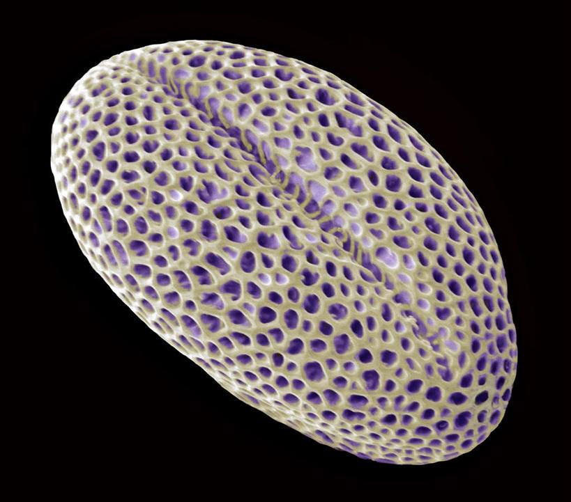 无人,横图,插画,室内,特写,白天,正面,数码,仪器,科技,阴影,黑色背景,检查,反射,分析,科学,网络,显微镜,高光,几何,计算机图形,合成,图画,画,紫色,油菜花,观察,清晰,探索,放大,观看,仔细,电脑合成图,数码合成图,透镜,凸透镜,聚焦,关注,漫画,花粉,写实,具体,具象,光学,清楚,电镜,彩图,芸苔,芸薹