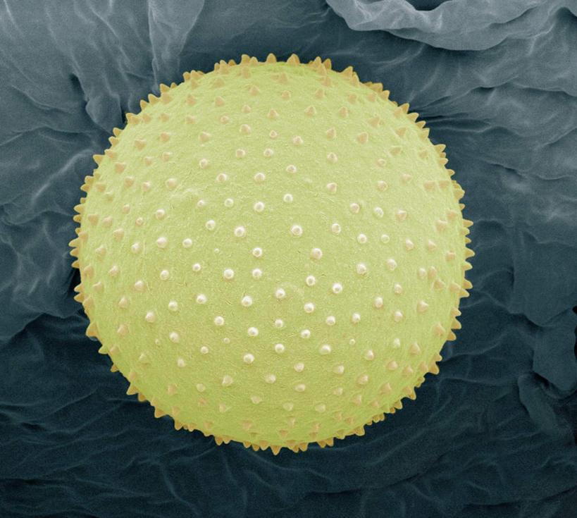 无人,横图,插画,室内,特写,白天,正面,数码,仪器,科技,阴影,检查,反射,分析,科学,网络,显微镜,高光,几何,计算机图形,合成,图画,画,一个,黄色,观察,清晰,探索,放大,单个,观看,仔细,电脑合成图,数码合成图,透镜,凸透镜,聚焦,关注,漫画,花粉,写实,具体,具象,光学,清楚,电镜,彩图