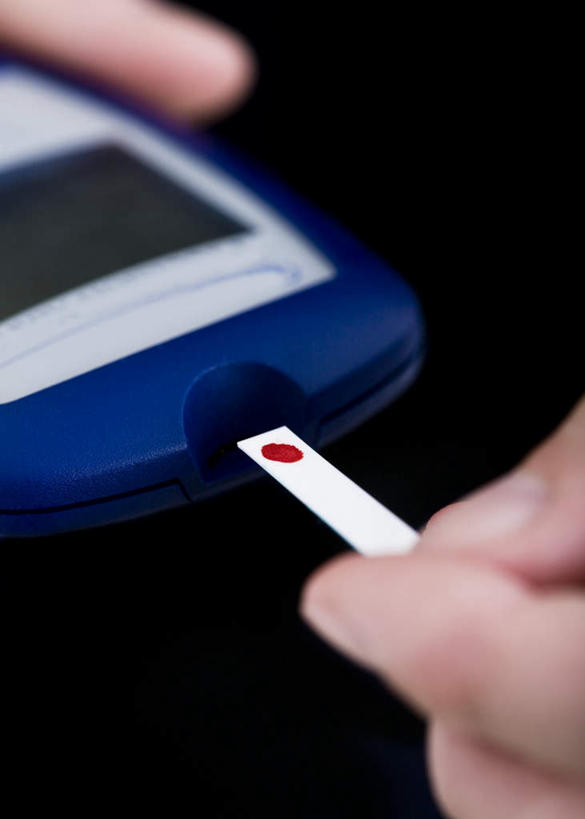 西方人,手,一个人,竖图,室内,特写,白天,白色背景,正面,欧洲,欧洲人,双手,仅一个年轻女性,仅一个女性,仅一个人,测试,手部,血液,摄影,影棚,样本,年轻女性,女人,女性,白种人,半身,彩图,影棚拍摄,拍摄